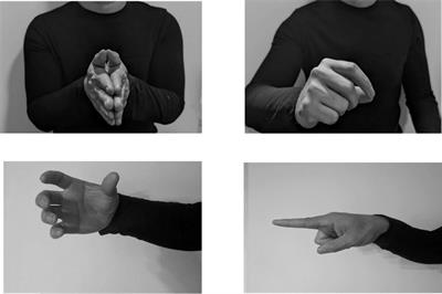 Characterizing iconic gesture during narratives in chronic traumatic brain injury recovery